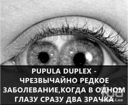 1035177 1500941